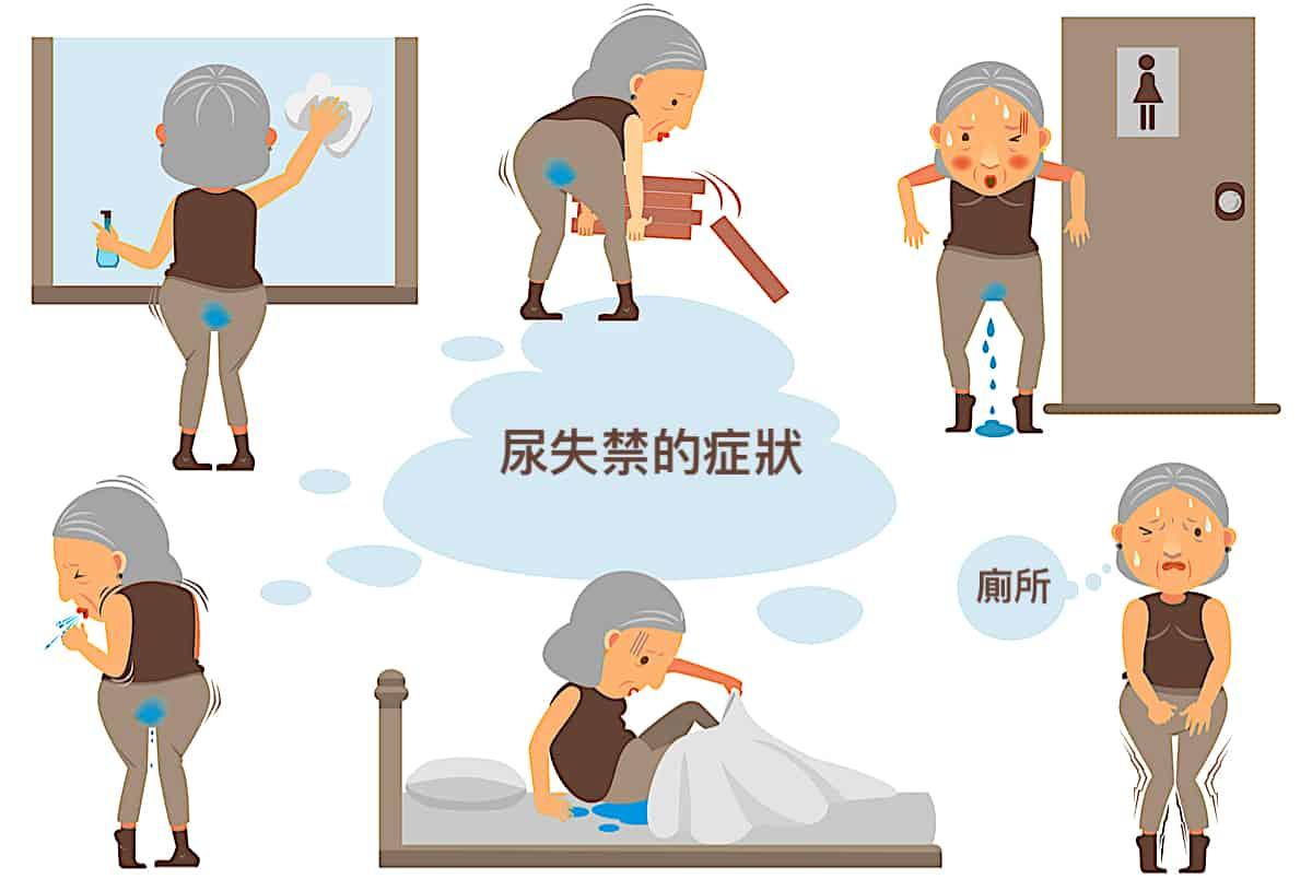 老人尿失禁的5大類型及原因！這樣運動和生活調整改善症狀