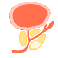攝護腺癌（前列腺癌）