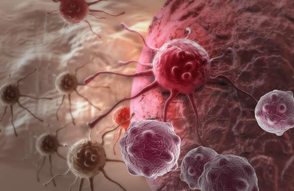 what-is-carcinoma-in-situ
